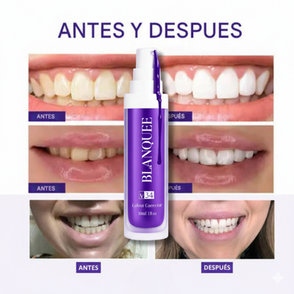 Blanquee™ – Deja que tu Sonrisa Hable por Ti